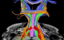 image sensor DTI技术如何提升成像性能？