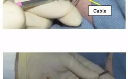 InsideOut技术是什么？核心原理是什么？