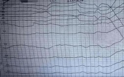 PerformTek心率技术如何精准监测心率？