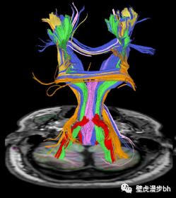 image sensor DTI技术如何提升成像性能？-图1