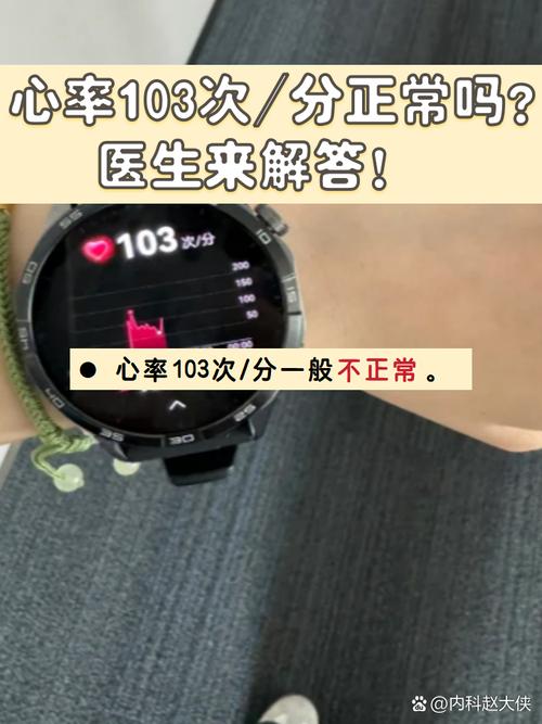 TruSeen 3.0心率技术准吗？原理是什么？-图3