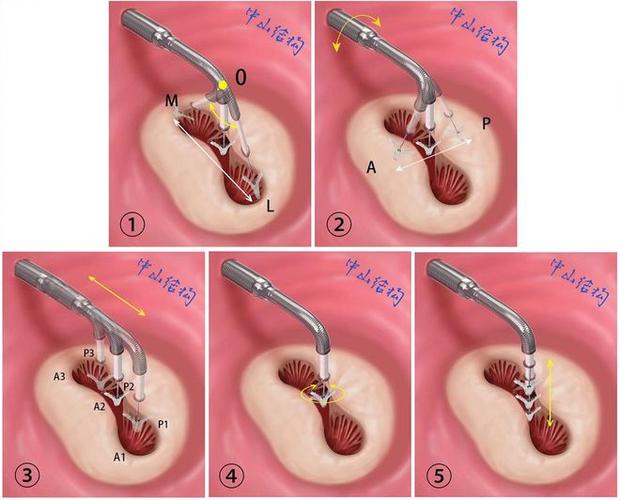 Trustonic TEE技术如何保障移动端安全?-图3 Trustonic TEE技术如何保障移动端安全?-图3