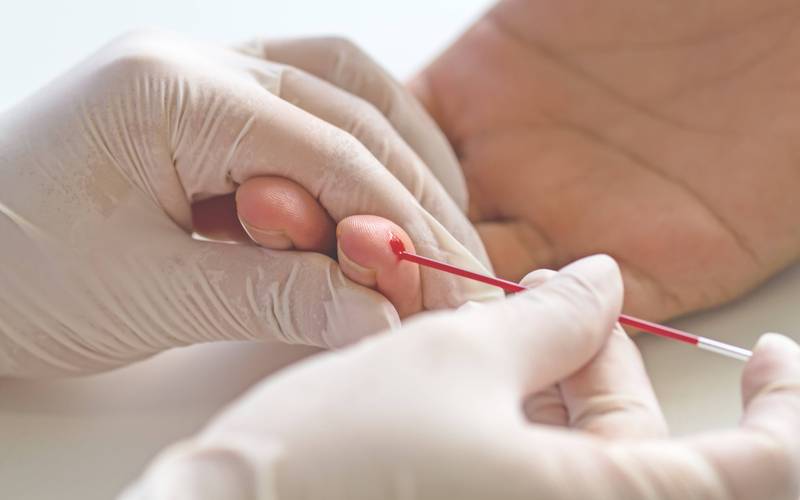 Theranos验血技术在中国为何未落地？-图3