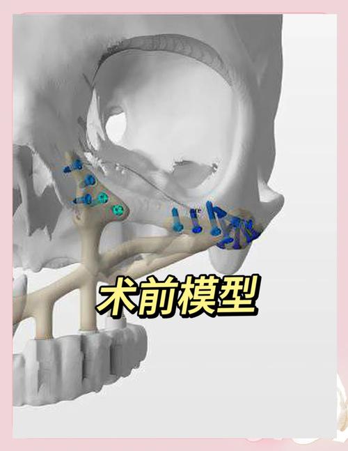 3D打印医学应用突破与挑战有哪些?-图3 3D打印医学应用突破与挑战有哪些?-图3