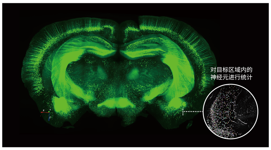 Clear-Vu显示技术如何实现视觉增强?-图1 Clear-Vu显示技术如何实现视觉增强?-图1