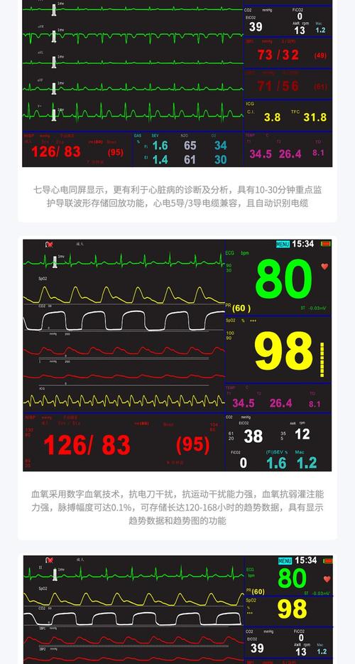 Truseen心率监测技术如何精准监测？-图2
