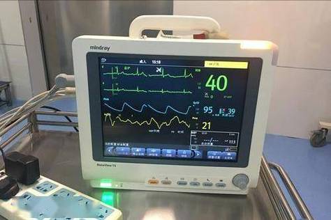 Truseen心率监测技术如何精准监测？-图1