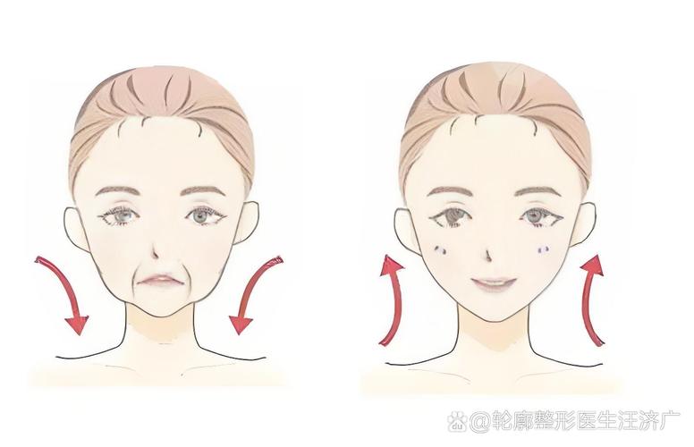 面部捕捉技术如何精准捕捉面部动作？-图2