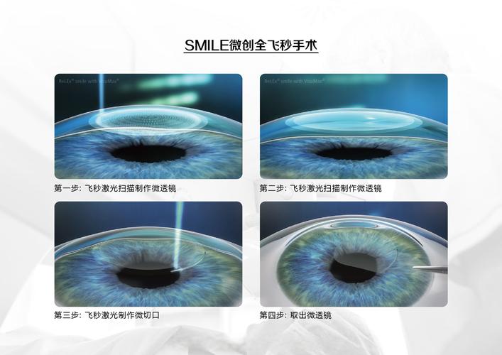 opticache技术-图1