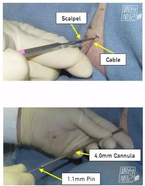 InsideOut技术是什么？核心原理是什么？-图1