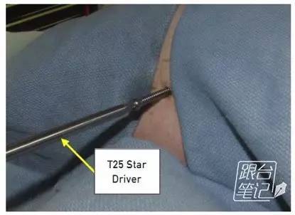 InsideOut技术是什么？核心原理是什么？-图2